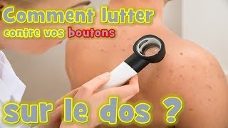 bouton dacné  Comment lutter naturellement contre vos boutons sur le dos [upl. by Sandler]