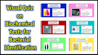 Visual Quiz on Biochemical tests for identification of bacteria  basicappliedmicrobiology [upl. by Chaunce659]