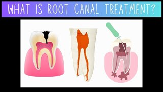 Root Canal Treatment and Dental Pulp  Dentistry [upl. by Lienahs577]