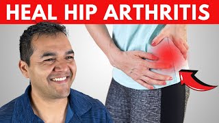 Top 3 Exercises to Help Calm Down Severe Hip Arthritis [upl. by Anirtap]