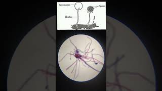 Rhizopus slide under MicroscopeMicroorganism [upl. by Kone]