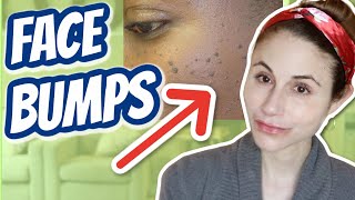 How to get rid of bumps on the face Dr Dray [upl. by Aerdnat]