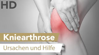 Arthrose im Kniegelenk Wie sie entsteht amp was du tun kannst [upl. by Tnahs917]