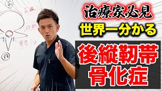 【開業した治療家なら見て】誰も教えてくれない！？後縦靭帯骨化を図解で分かりやすく徹底解説 [upl. by Nailuj]