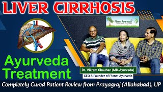 Liver Cirrhosis Ayurveda Treatment  Completely Cured Patient Review from Prayagraj Allahabad UP [upl. by Leventhal171]