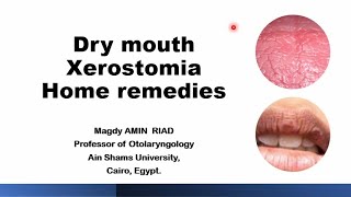 Home remedies for Dry mouth Xerostomia [upl. by Geraldine]