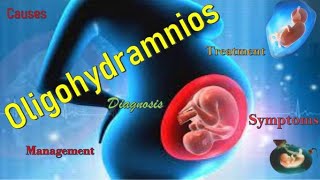 Oligohydramnios Causes Pathophysiology Symptoms Diagnosis Complications and Treatment [upl. by Elrak]