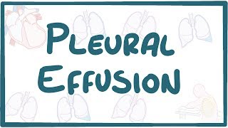 Pleural Effusion  causes symptoms diagnosis treatment pathology [upl. by Hiett]