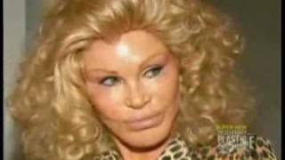 How Much Plastic Surgery did Cat Lady Jocelyn Wildenstein Have Done [upl. by Leandro]