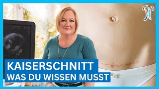 Gynäkologin erklärt Kaiserschnitt  Ablauf Narbe amp Heilung – Was du wissen musst [upl. by Sheldon]