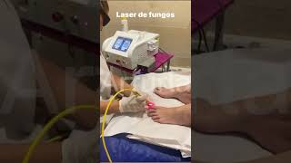 Arfurla laser nail fungus treatment equipment with 980nm 600um optical fiber toenail fungusremoval [upl. by Aluk]