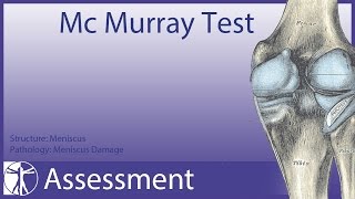 McMurray Test  Meniscus Damage update in description [upl. by Aihsoj]