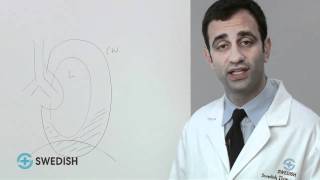 Mesothelioma and Malignant Pleural Issues [upl. by Lorac]