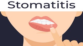 stomatitiscauses of stomatitissymptoms of stomatitisshort [upl. by Hagerman138]