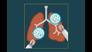 Pneumocystis jiroveci pneumonia pcp [upl. by Pihc]