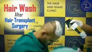 Hair Wash After Hair Transplant surgery at The Hair And Shape Clinic Malad Mumbai [upl. by Yrhcaz828]