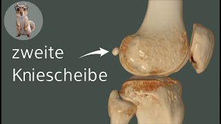 Die zweite Kniescheibe  die Fabella anatomie medizin anatomy [upl. by Arihat482]