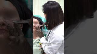 This Treatment 👩‍⚕ helps to make your skin healthy😍  Dr Priyanka Reddy  DNA Skin Clinic  short [upl. by Grant]