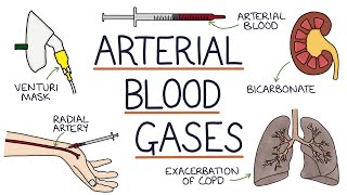 Understanding Arterial Blood Gases [upl. by Ermin]