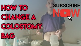 How to change a colostomy stoma bag [upl. by Auqinahs738]