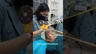 Melasma Treatment melasma treatmentwajah flekhitamdiwajah flekhitamhilang [upl. by Asuncion578]