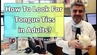 How To Look For Tongue Ties In Adults [upl. by Aicilihp]