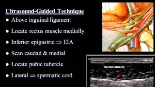 Pain Medicine  Ilioinguinal Nerve Iliohypogastric Nerve Inguinal Canal TAP [upl. by Nnaesor]