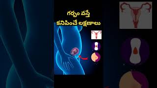 గర్భం వస్తె కనిపించే లక్షణాలు  Early pregnancy symptoms [upl. by Veejar]