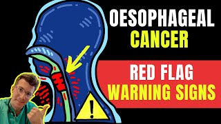 Warning signs amp symptoms of OESOPHAGEALAKA esophageal gullet CANCER  Doctor ODonovan explains [upl. by Muscolo]