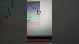 Intraday Trading 📈🤑 Bank Nifty and Nifty Trade😍 Stock Market Status Video  trading shorts [upl. by Hightower316]