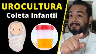 Urocultura em crianças e bebês como fazer a coleta de urina  cultura de urina [upl. by Cayser545]