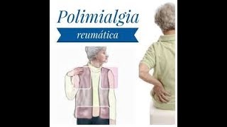 Tudo Sobre Polimialgia Reumática [upl. by Atinas791]