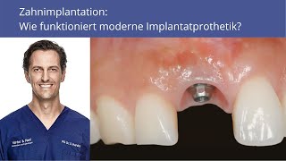 Zahnimplantation Wie funktioniert moderne Implantatprothetik [upl. by Novek]