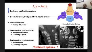 ASSI Webinar on Odontoid Fractures [upl. by Urien174]