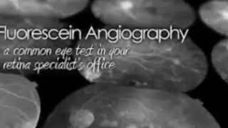 EYE ANGIOGRAPHY FLUORESCEIN ANGIOGRAPHY KNOW ABOUT PHLF [upl. by Adnical181]