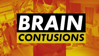 Contusion  traumatic brain injury explained [upl. by Charters]