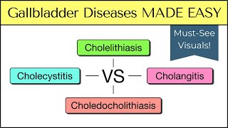 Cholecystitis vs Cholelithiasis vs Cholangitis vs Choledocholithiasis Nursing USMLE [upl. by Noble390]