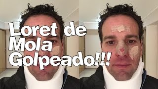 Accidente Carlos Loret de Mola Golpeado no quiere a su papá Rafael Loret de Mola [upl. by Yrekaz]