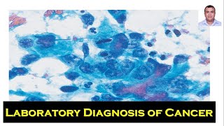 17  Laboratory Diagnosis of Cancer [upl. by Stace]