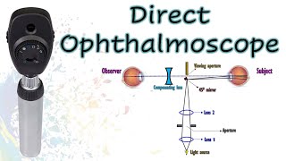 The Direct Ophthalmoscope  Know Your Instrument 1 [upl. by Ahcsrop]