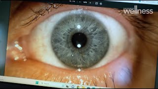 Exploring the power of iridology by unlocking the secrets of your health through the eyes [upl. by Eclud]