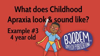 Childhood Apraxia of Speech  Example 3 [upl. by Olette]