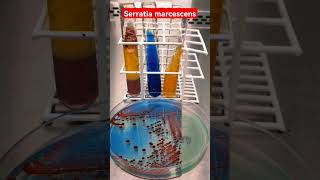 Serratia marcescens on CLED Agar  Urine culture Microbiology [upl. by Orutra]