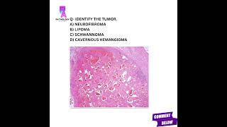 Histopathology questions histopathology mbbs md pathologyacademy draditikumar [upl. by Atalanti]