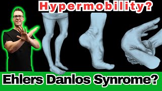 Ehlers Danlos Syndrome Hypermobility Symptoms Diagnosis amp Test [upl. by Eeroc]