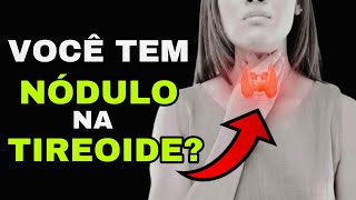 7 SINAIS PERIGOSOS de um NÓDULO na TIREOIDE Sintomas de Câncer na Tireoide [upl. by Rempe596]