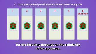 09 Nano amp Micro cell block discs after tissue processing Instructions to histotechnologists [upl. by Eyma]