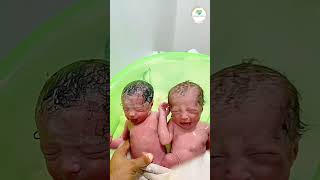 Twins Baby in the First Bath  newbornbaby cutebaby normaldeliverytips pregnancytips littlebaby [upl. by Eimaral894]