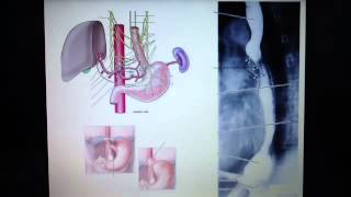 Esophagus  innervation and clinical correlates [upl. by Beekman]