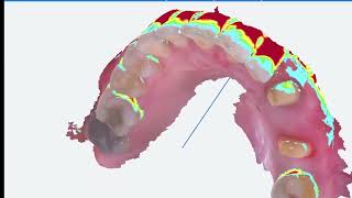 E2 Fussen IntraOral Scanner S6000 Tools [upl. by Bohannon]